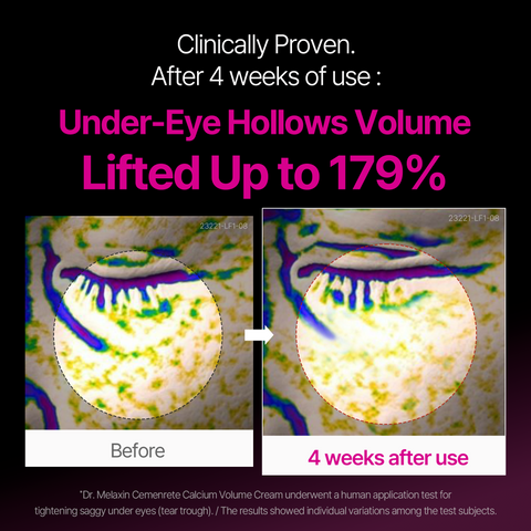 Dr.Melaxin Calcium Eyecare Routine Set