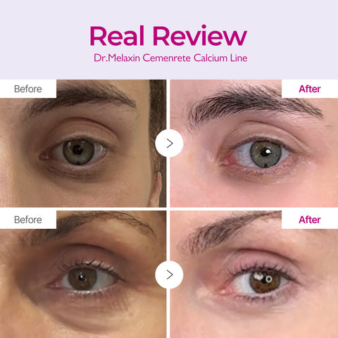 Dr.Melaxin Calcium Eyecare Routine Set