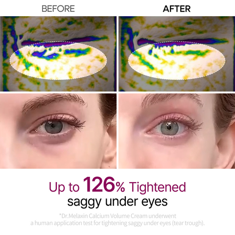 Dr.Melaxin Calcium Eye Care Line